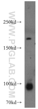 ADCY3 Antibody in Western Blot (WB)