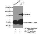 ADCY3 Antibody in Immunoprecipitation (IP)