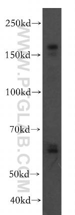 VLDLR Antibody in Western Blot (WB)