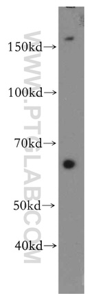 VLDLR Antibody in Western Blot (WB)