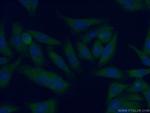 AFM Antibody in Immunocytochemistry (ICC/IF)