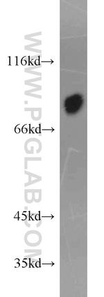 AFM Antibody in Western Blot (WB)