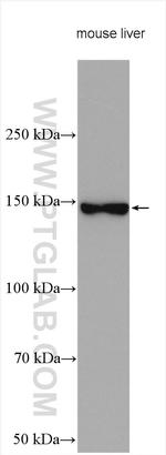 Aldehyde oxidase Antibody in Western Blot (WB)