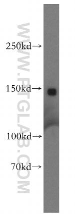 Aldehyde oxidase Antibody in Western Blot (WB)