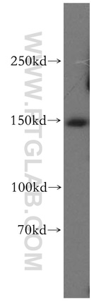 Aldehyde oxidase Antibody in Western Blot (WB)