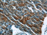 FUT4 Antibody in Immunohistochemistry (Paraffin) (IHC (P))