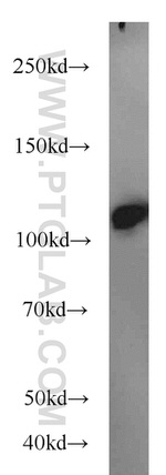 FUT4 Antibody in Western Blot (WB)