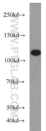 FUT4 Antibody in Western Blot (WB)