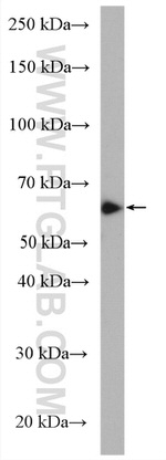 FUT4 Antibody in Western Blot (WB)