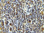 LRMP Antibody in Immunohistochemistry (Paraffin) (IHC (P))