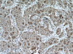 SULT1A3 Antibody in Immunohistochemistry (Paraffin) (IHC (P))