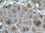 SULT1A3 Antibody in Immunohistochemistry (Paraffin) (IHC (P))
