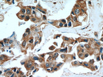 SULT1A3 Antibody in Immunohistochemistry (Paraffin) (IHC (P))