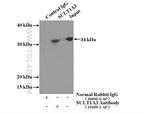 SULT1A3 Antibody in Immunoprecipitation (IP)