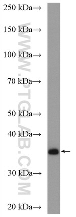 SULT1A3 Antibody in Western Blot (WB)