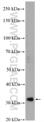 SULT1A3 Antibody in Western Blot (WB)