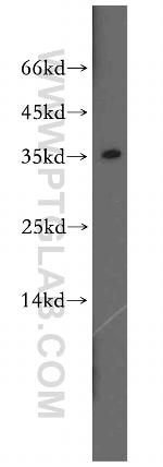 SULT1A3 Antibody in Western Blot (WB)