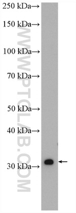 SULT1A3 Antibody in Western Blot (WB)