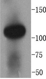 Angiotensin Converting Enzyme 2 (ACE2) Antibody in Western Blot (WB)