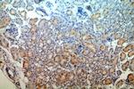 MAST3 Antibody in Immunohistochemistry (Paraffin) (IHC (P))