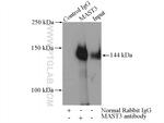 MAST3 Antibody in Immunoprecipitation (IP)