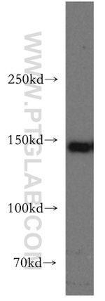 MAST3 Antibody in Western Blot (WB)