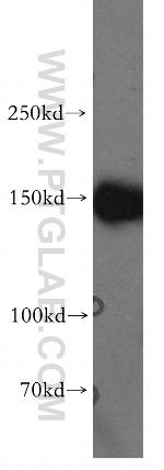 MAST3 Antibody in Western Blot (WB)