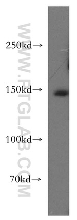 MAST3 Antibody in Western Blot (WB)