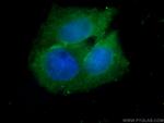 PACS2 Antibody in Immunocytochemistry (ICC/IF)