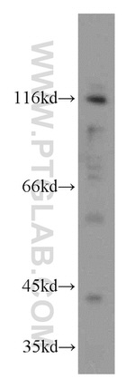 PACS2 Antibody in Western Blot (WB)