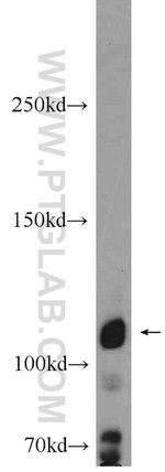 PACS2 Antibody in Western Blot (WB)