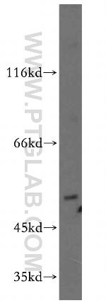 EDG7 Antibody in Western Blot (WB)