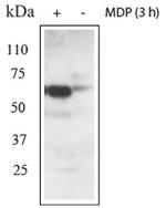 RIPK2 Antibody in Western Blot (WB)