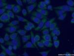 MRAP Antibody in Immunocytochemistry (ICC/IF)