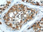 MRAP Antibody in Immunohistochemistry (Paraffin) (IHC (P))