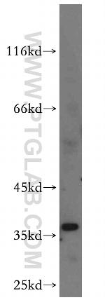 MOGAT2 Antibody in Western Blot (WB)