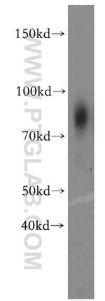 TXNRD3 Antibody in Western Blot (WB)