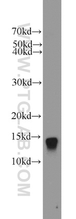 ATP6V1G3 Antibody in Western Blot (WB)