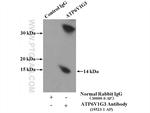 ATP6V1G3 Antibody in Immunoprecipitation (IP)
