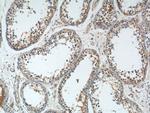 TICAM2 Antibody in Immunohistochemistry (Paraffin) (IHC (P))