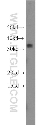 TICAM2 Antibody in Western Blot (WB)