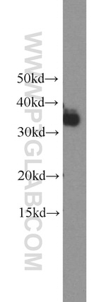 TICAM2 Antibody in Western Blot (WB)