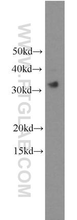 TICAM2 Antibody in Western Blot (WB)