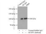 SENP5 Antibody in Immunoprecipitation (IP)