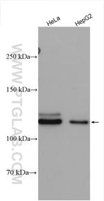 SENP5 Antibody in Western Blot (WB)