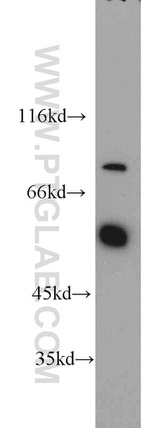 SENP5 Antibody in Western Blot (WB)