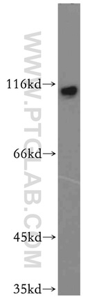 SENP5 Antibody in Western Blot (WB)