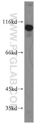 SENP5 Antibody in Western Blot (WB)