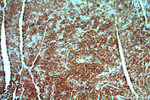 GATA4 Antibody in Immunohistochemistry (Paraffin) (IHC (P))