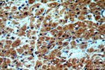 GATA4 Antibody in Immunohistochemistry (Paraffin) (IHC (P))